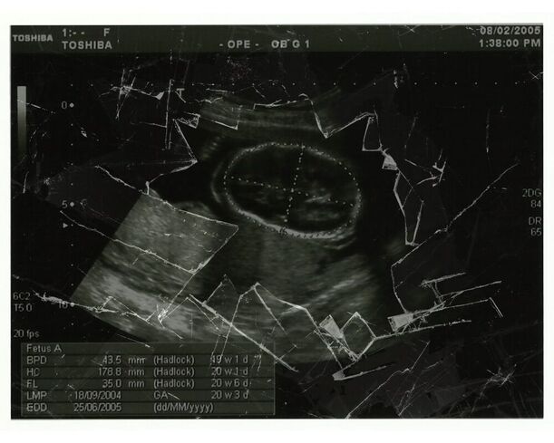 digitally modified picture of a pregnancy scan covered by broken glass.